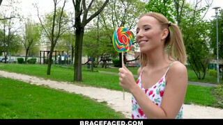 BraceFaced - foncsikos és fogszabályzós fiatal maca